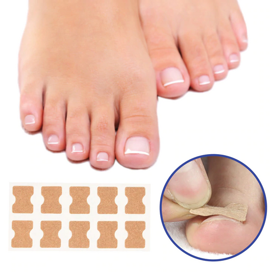 NailFixer™ - Nail Correction Sticker Strips (50% OFF)