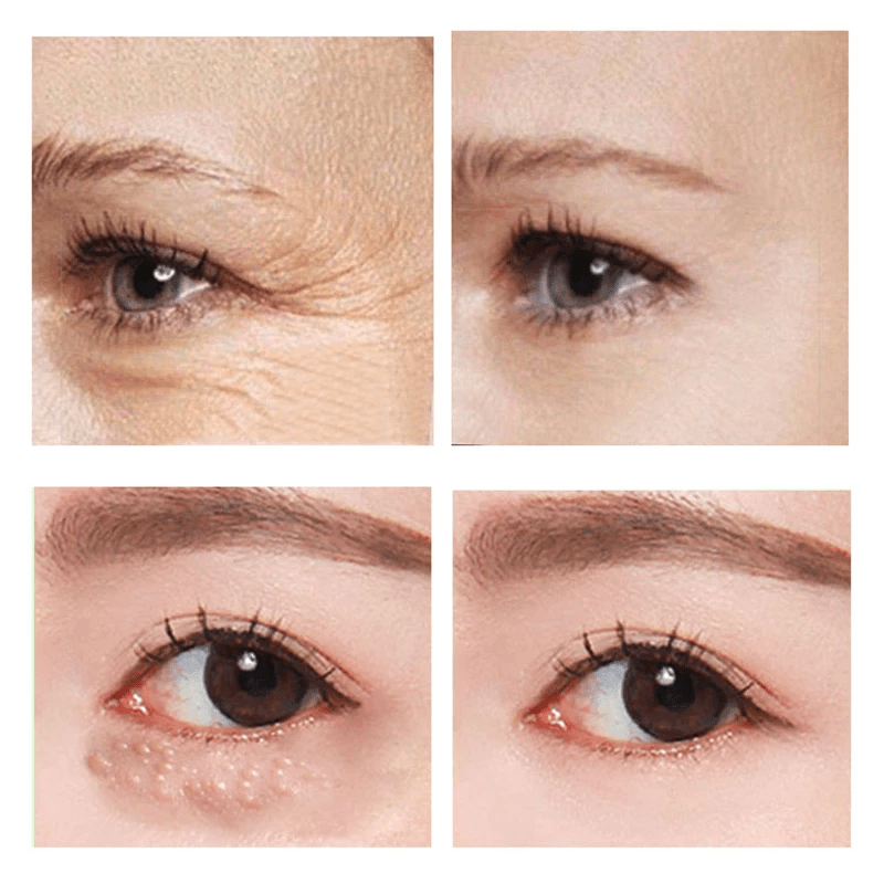1+1 Free | SleekEyes™ Fast Acting Firming Eye Cream