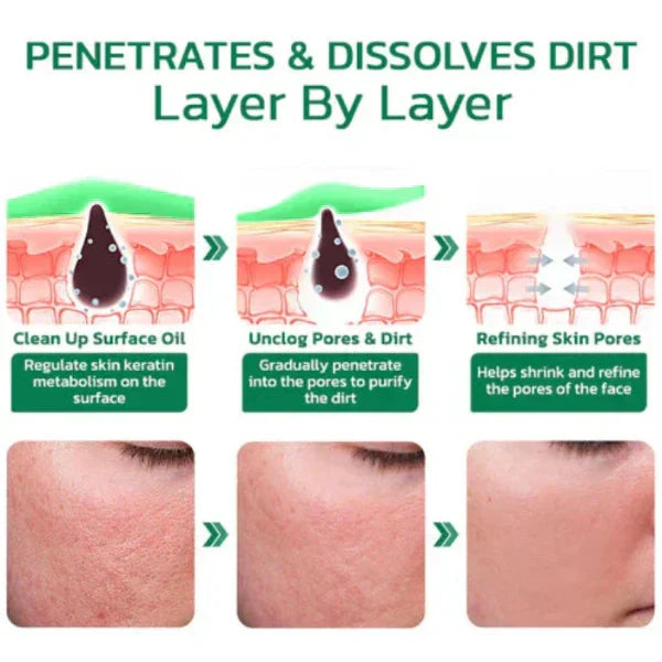 Greenify™ - Original Matcha Deep Cleaning Mask Stick (50% DISCOUNT)