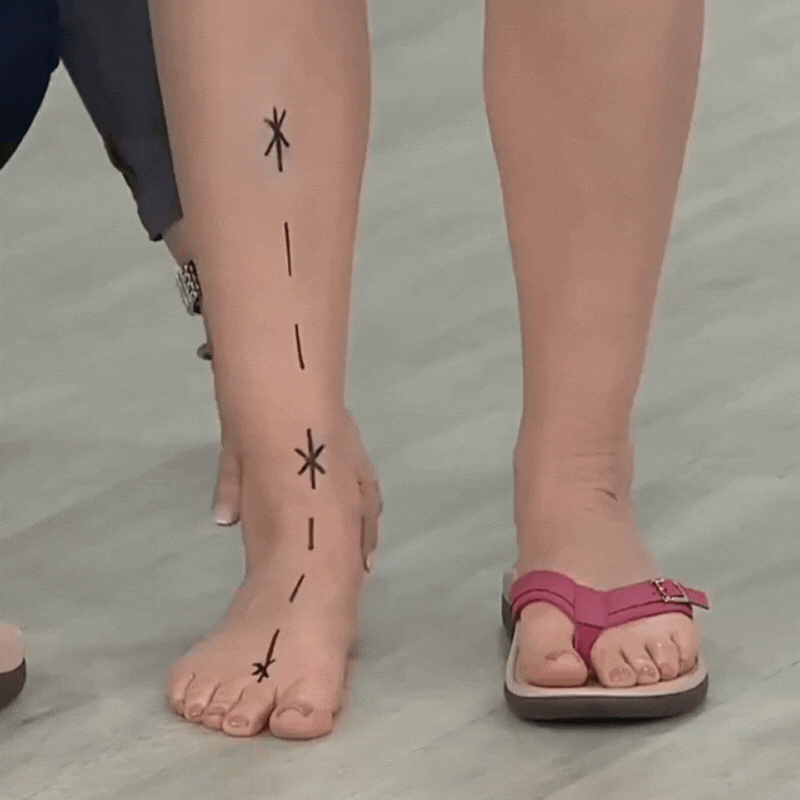 Ellendor's Orthopedic Summer Sandals (50% Off)