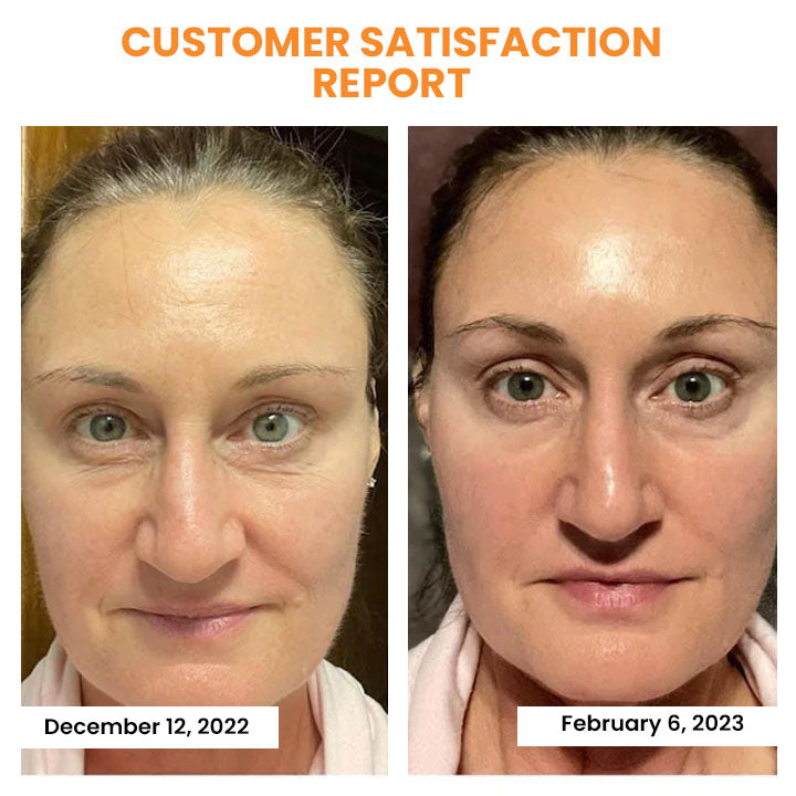 SkinRevive™ - Collagen Film Mask (Buy 1 Get 1 Free)